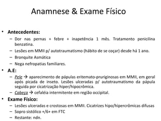 Anamnese & Exame Físico  Antecedentes: Dor nas pernas + febre + inapetência 1 mês. Tratamento penicilina benzatina. Lesões em MMII p/ autotraumatismo (hábito de se coçar) desde há 1 ano. Bronquite Asmática Nega nefropatias familiares. A.E: Pele     aparecimento de pápulas eritemato-pruriginosas em MMII, em geral após picada de inseto. Lesões ulceradas p/ autotraumatismo da pápula seguida por cicatrização hiper/hipocrômica. Cabeça     cefaléia intermitente em região occipital. Exame Físico: Lesões ulceradas e crostosas em MMII. Cicatrizes hipo/hipercrômicas difusas Sopro sistólico +/6+ em FTC Restante: ndn. 