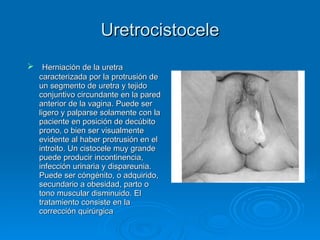 Uretrocistocele Herniación de la uretra caracterizada por la protrusión de un segmento de uretra y tejido conjuntivo circundante en la pared anterior de la vagina. Puede ser ligero y palparse solamente con la paciente en posición de decúbito prono, o bien ser visualmente evidente al haber protrusión en el introito. Un cistocele muy grande puede producir incontinencia, infección urinaria y dispareunia. Puede ser cóngénito, o adquirido, secundario a obesidad, parto o tono muscular disminuido. El tratamiento consiste en la corrección quirúrgica   