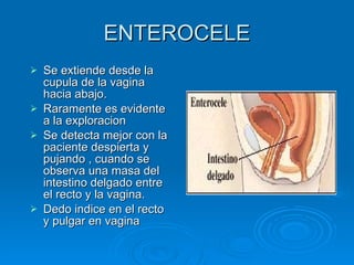 ENTEROCELE Se extiende desde la cupula de la vagina hacia abajo. Raramente es evidente a la exploracion Se detecta mejor con la paciente despierta y pujando , cuando se observa una masa del intestino delgado entre el recto y la vagina. Dedo indice en el recto y pulgar en vagina 