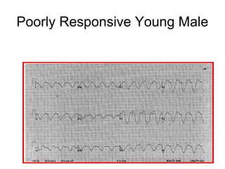 Poorly Responsive Young Male
 