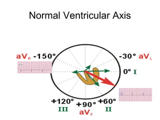 Normal Ventricular Axis
 