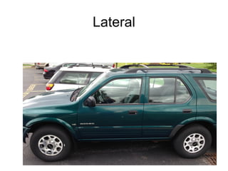 Lateral
 