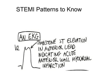 STEMI Patterns to Know
 
