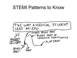 STEMI Patterns to Know
 