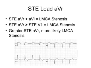 STE Lead aVr
• STE aVr + aVl = LMCA Stenosis
• STE aVr > STE V1 = LMCA Stenosis
• Greater STE aVr, more likely LMCA
Stenosis
 