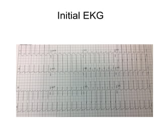 Initial EKG
 