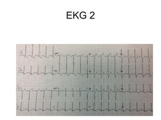 EKG 2
 