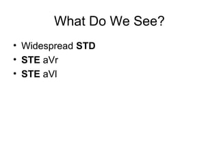 What Do We See?
• Widespread STD
• STE aVr
• STE aVl
 