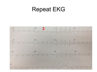 Repeat EKG
 