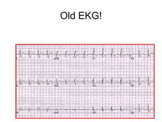 Old EKG!
 