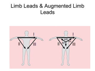 Limb Leads & Augmented Limb
Leads
 