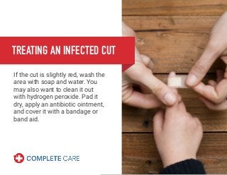 TREATING AN INFECTED CUT
If the cut is slightly red, wash the
area with soap and water. You
may also want to clean it out
with hydrogen peroxide. Pad it
dry, apply an antibiotic ointment,
and cover it with a bandage or
band aid.
 