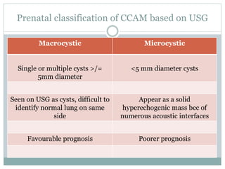 Congenital cystic adenomatoid malformation | PPTX