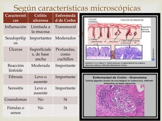 
Según características microscópicas
Característi
cas
Colitis
ulcerosa
Enfermeda
d de Crohn
Inflamación Limitada a
la mucosa
Transmural
Seudopólip
os
Importantes Moderados
Úlceras Superficiale
s, de base
ancha
Profundas,
como
cuchillos
Reacción
linfoide
Moderada Importante
Fibrosis Leve o
ausente
Importante
Serositis Leve o
ausente
Importante
Granulomas No Sí
Fístulas o
senos
No Sí
 