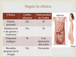 
Según la clínica
Clínica Colitis
ulcerosa
Enfermedad
de Crohn
Fístula
perianal
No Sí
Malabsorció
n de grasas y
vitaminas
No Sí
Potencial
maligno
Sí Con
afectación
del colon
Recaídas
después de la
cirugía
No Frecuente
 