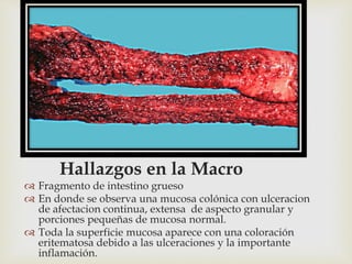 
Hallazgos en la Macro
 Fragmento de intestino grueso
 En donde se observa una mucosa colónica con ulceracion
de afectacion continua, extensa de aspecto granular y
porciones pequeñas de mucosa normal.
 Toda la superficie mucosa aparece con una coloración
eritematosa debido a las ulceraciones y la importante
inflamación.
 
