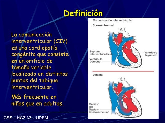 Cardiopatia Congenita Cianogena Mas Frecuente