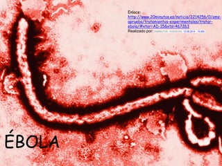 ÉBOLA
ÉBOLA
Enlace:
http://www.20minutos.es/noticia/2214256/0/oms-
aprueba/tratamientos-experimentales/tratar-
ebola/#xtor=AD-15&xts=467263
Realizado por: 20MINUTOS / AGENCIAS. 12.08.2014 - 15:50h
 