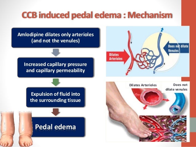 Calcium Channel Blockers in Hypertension Calcium Channel Blockers in Hypertension