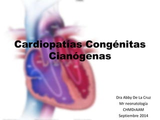 Cardiopatías Congénitas 
Cianógenas 
Dra Abby De La Cruz 
Mr neonatología 
CHMDrAAM 
Septiembre 2014 
 