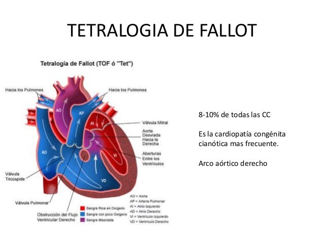 Cardiopatia Congenita Cianogena Mas Frecuente