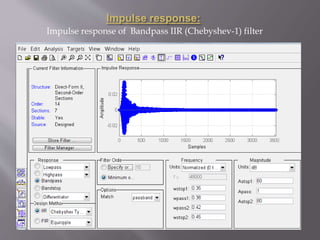 Impulse response:
Impulse response of Bandpass IIR (Chebyshev-1) filter
 