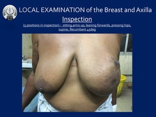 Inspection
(5 positions in inspection) - sitting,arms up, leaning forwards, pressing hips,
supine, Recumbant 45deg
 