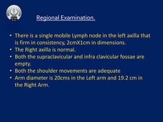 • There is a single mobile Lymph node in the left axilla that
is firm in consistency, 2cmX1cm in dimensions.
• The Right axilla is normal.
• Both the supraclavicular and infra clavicular fossae are
empty.
• Both the shoulder movements are adequate
• Arm diameter is 20cms in the Left arm and 19.2 cm in
the Right Arm.
Regional Examination.
 