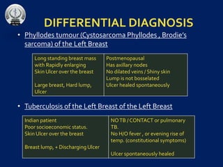 DIFFERENTIAL DIAGNOSIS
• Phyllodes tumour (Cystosarcoma Phyllodes , Brodie’s
sarcoma) of the Left Breast
• Tuberculosis of the Left Breast of the Left Breast
Long standing breast mass
with Rapidly enlarging
Skin Ulcer over the breast
Large breast, Hard lump,
Ulcer
Postmenopausal
Has axillary nodes
No dilated veins / Shiny skin
Lump is not bosselated
Ulcer healed spontaneously
Indian patient
Poor socioeconomic status.
Skin Ulcer over the breast
Breast lump, + Discharging Ulcer
NOTB / CONTACT or pulmonary
TB.
No H/O fever , or evening rise of
temp. (constitutional symptoms)
Ulcer spontaneously healed
 