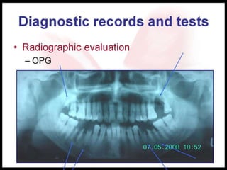 Diagnostic records and tests