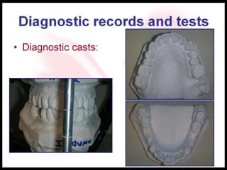 Diagnostic records and tests