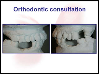 Orthodontic consultation