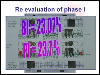 Re evaluation of phase I