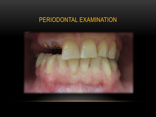 Dental Clinical Comprehensive Case (CCC) | PDF