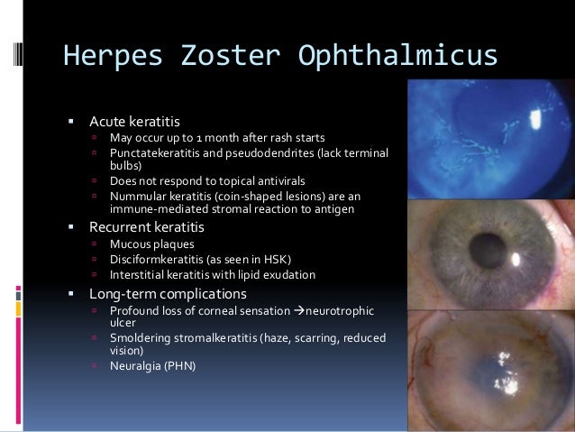 Herpes Viral Infections of the Eye - MedicineNet