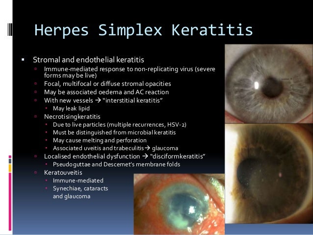 Herpes Simplex Virus (HSV) Infections - The Merck Manuals