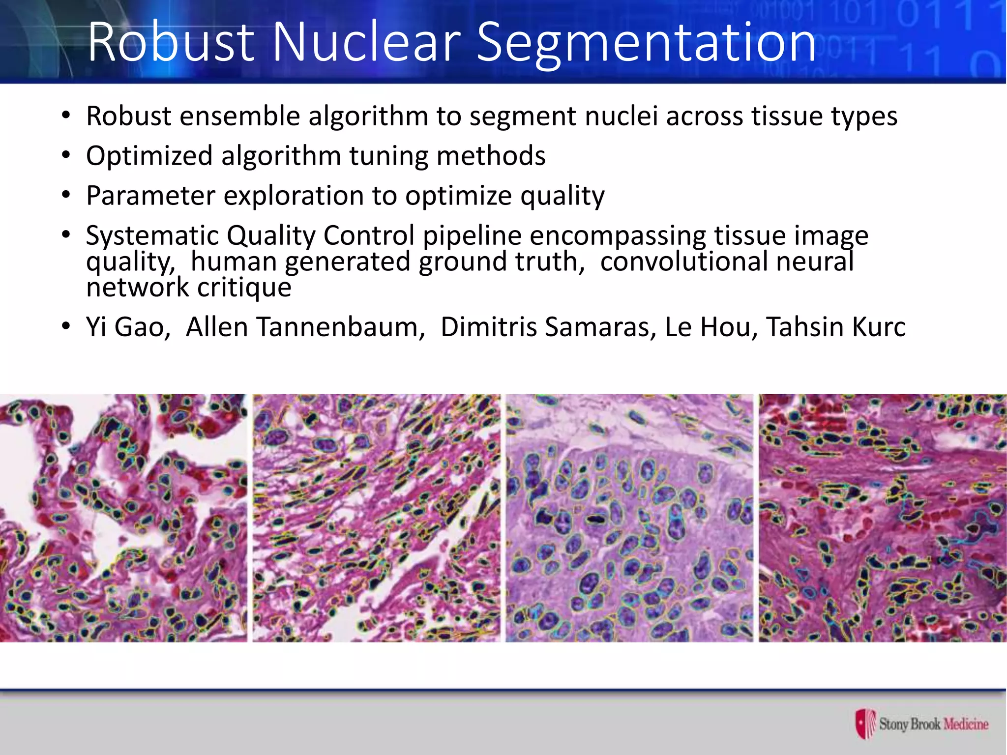 Robust Nuclear Segmentation
• Robust ensemble algorithm to segment nuclei across tissue types
• Optimized algorithm tuning methods
• Parameter exploration to optimize quality
• Systematic Quality Control pipeline encompassing tissue image
quality, human generated ground truth, convolutional neural
network critique
• Yi Gao, Allen Tannenbaum, Dimitris Samaras, Le Hou, Tahsin Kurc
 