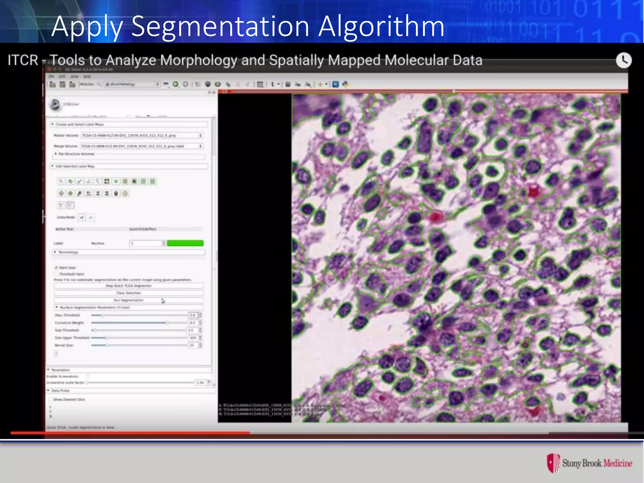 Apply Segmentation Algorithm
 