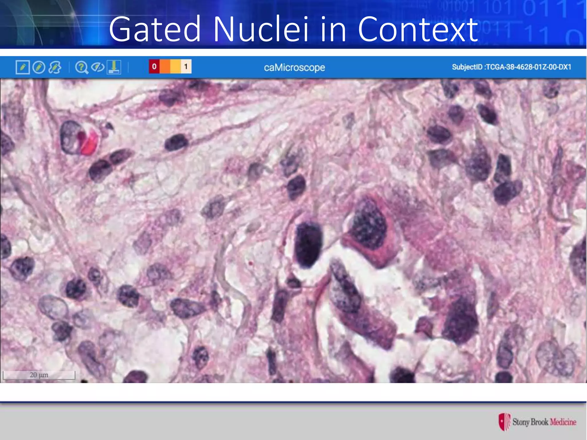 Gated Nuclei in Context
 