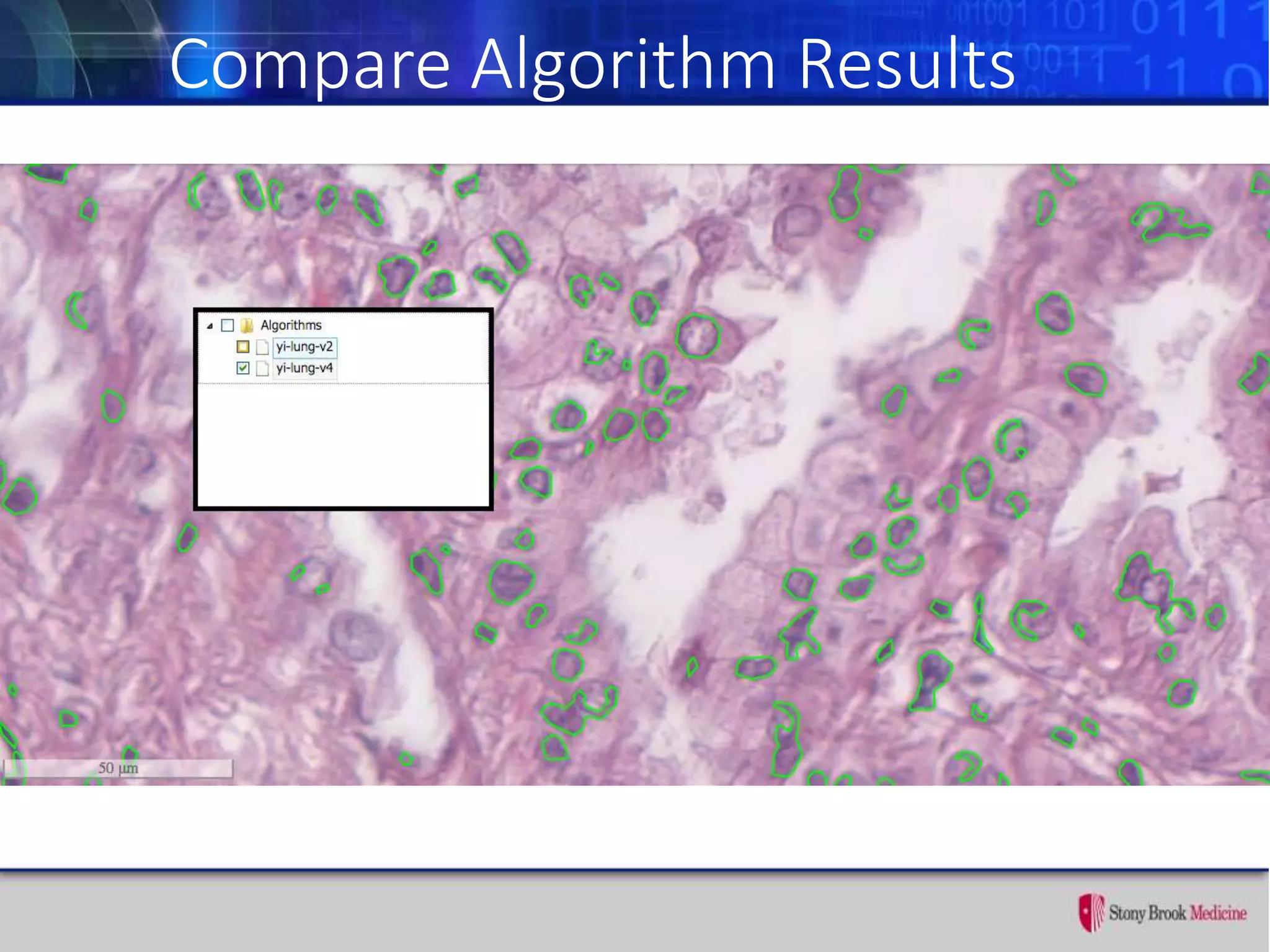 Compare Algorithm Results
 
