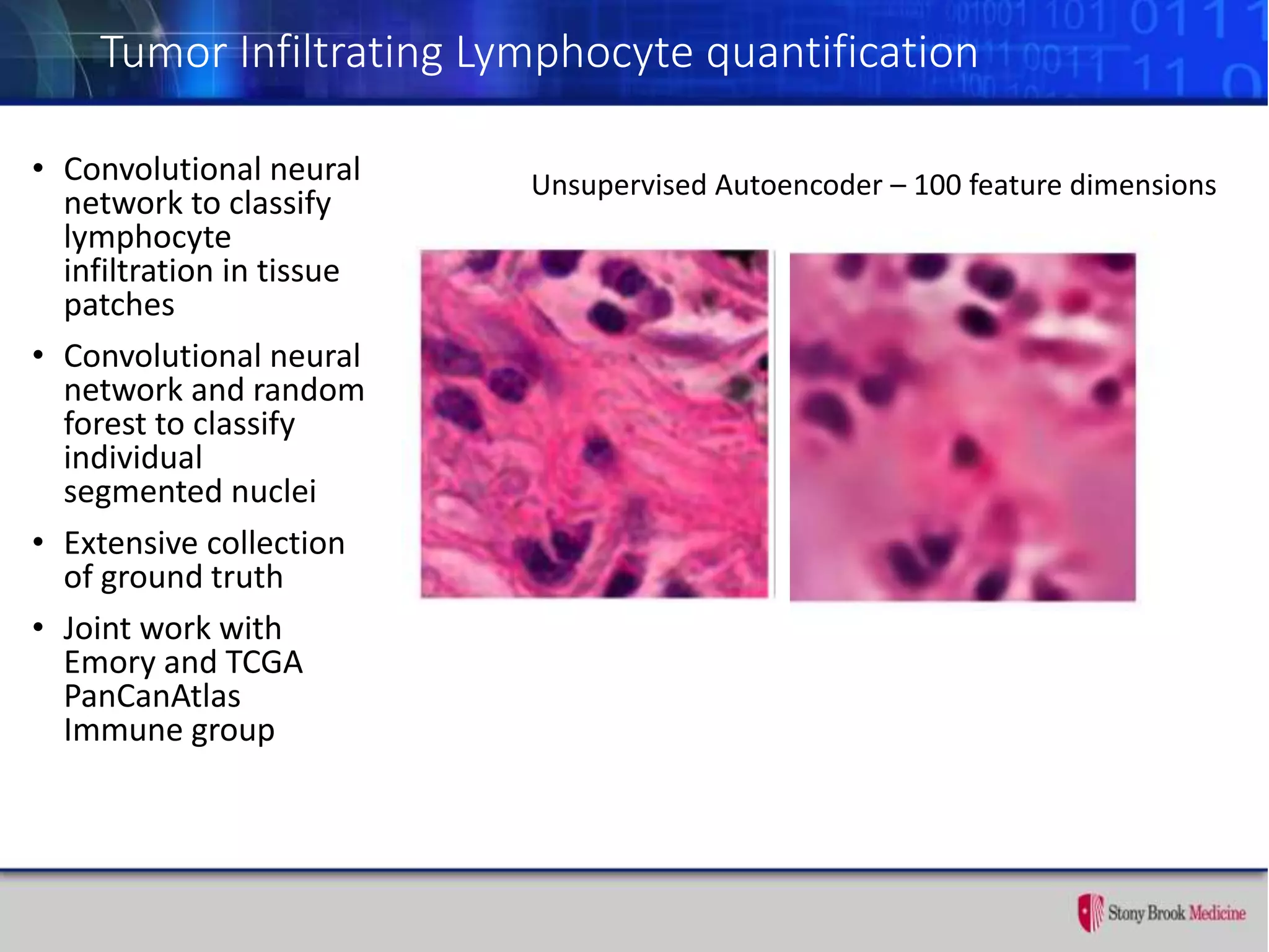 Tumor Infiltrating Lymphocyte quantification
• Convolutional neural
network to classify
lymphocyte
infiltration in tissue
patches
• Convolutional neural
network and random
forest to classify
individual
segmented nuclei
• Extensive collection
of ground truth
• Joint work with
Emory and TCGA
PanCanAtlas
Immune group
Unsupervised Autoencoder – 100 feature dimensions
 