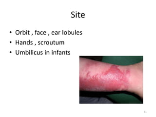 Site
• Orbit , face , ear lobules
• Hands , scroutum
• Umbilicus in infants
11
 