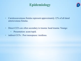 Caroticocavernous fistula CCF | PPTX