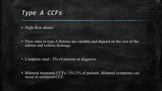 Carotid cavernous fistula | PPTX