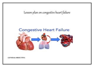 Lesson plan on congestive heart failure
GENERALOBJECTIVE:
 