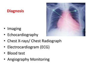 Congestive cardiac failure (CCF) | PPT