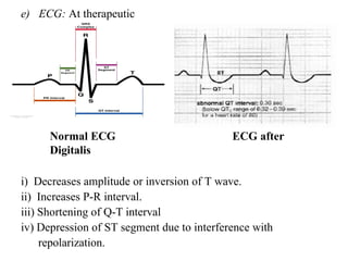 e) ECG: At therapeutic
doses
Normal ECG ECG after
Digitalis
i) Decreases amplitude or inversion of T wave.
ii) Increases P-R interval.
iii) Shortening of Q-T interval
iv) Depression of ST segment due to interference with
repolarization.
 