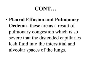 CONT…
• Pleural Effusion and Pulmonary
Oedema- these are as a result of
pulmonary congestion which is so
severe that the distended capillaries
leak fluid into the interstitial and
alveolar spaces of the lungs.
 