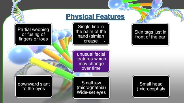 Cri du chat syndrome,