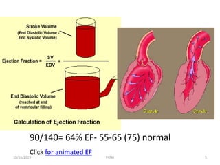 90/140= 64% EF- 55-65 (75) normal
Click for animated EF
10/16/2019 5PATKI
 